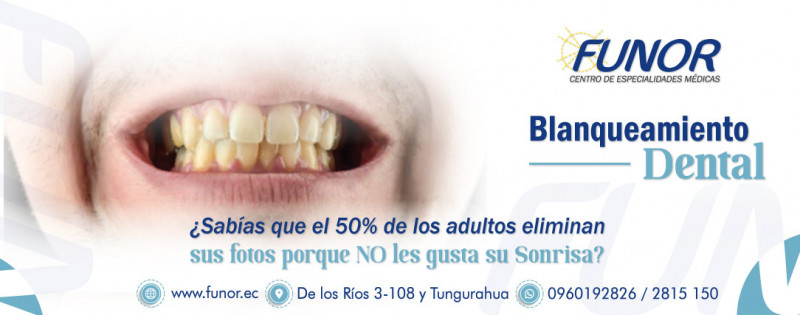 Blanqueamiento Dental 